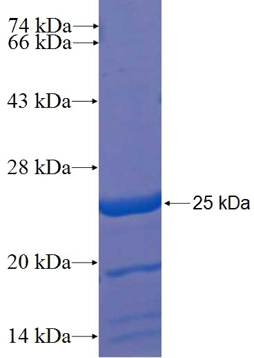 Recombinant Human ZNF774 SDS-PAGE