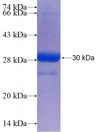 Recombinant Human SHQ1 SDS-PAGE