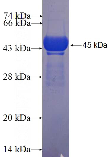Recombinant Human MTMR7 SDS-PAGE