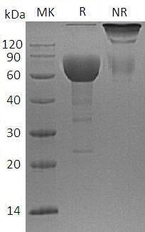 Human SLAMF6/KALI/UNQ6123/PRO20080 (Fc tag) recombinant protein