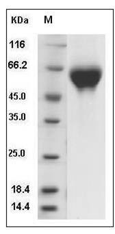 Rat IL1R2 / IL1RB / CD121b Protein (His Tag) SDS-PAGE