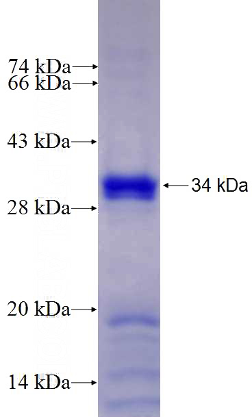 Recombinant Human USP8 SDS-PAGE