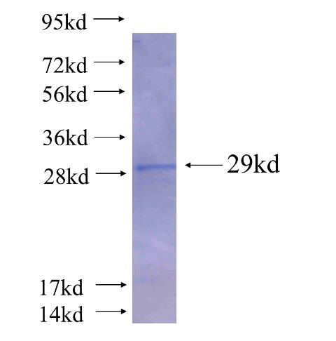 Recombinant human ACSM5(Full length) SDS-PAGE