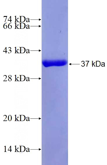 Recombinant Human PLCD4 SDS-PAGE