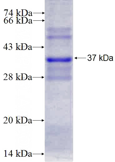 Recombinant Human DNAJC10 SDS-PAGE