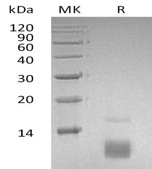 Human CCL5/D17S136E/SCYA5 recombinant protein