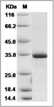 Human Esterase D / ESD Protein (His Tag) SDS-PAGE