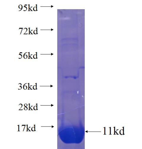 Recombinant human SLC7A7 SDS-PAGE