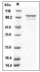 Human DAPK3 / ZIPK Protein (GST Tag) SDS-PAGE