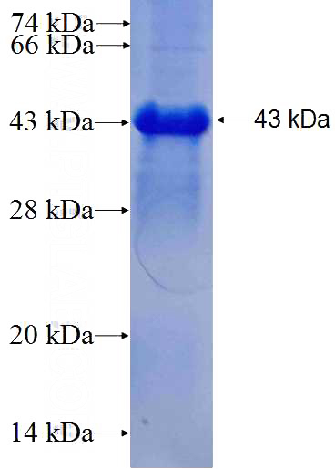 Recombinant Human ANKRD17 SDS-PAGE