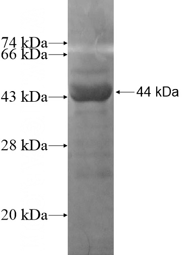 Recombinant Human DBP SDS-PAGE