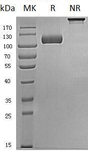 Human SEMA5A/SEMAF (His tag) recombinant protein