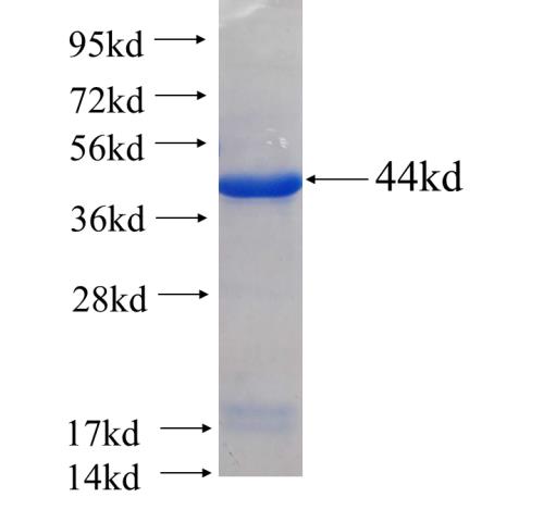 Recombinant human ETFDH SDS-PAGE