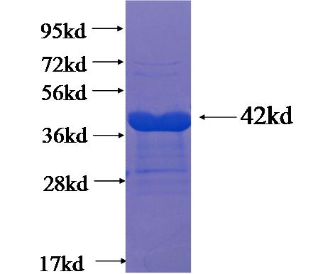 Recombinant Arabidopsis thaliana NTMC2T1.1 SDS-PAGE