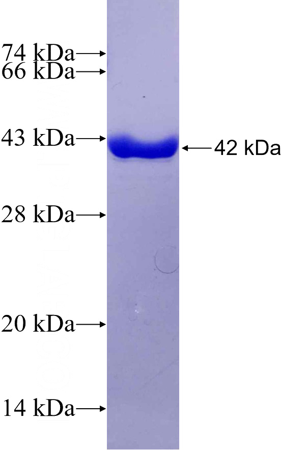 Recombinant Human PTPLAD1 SDS-PAGE