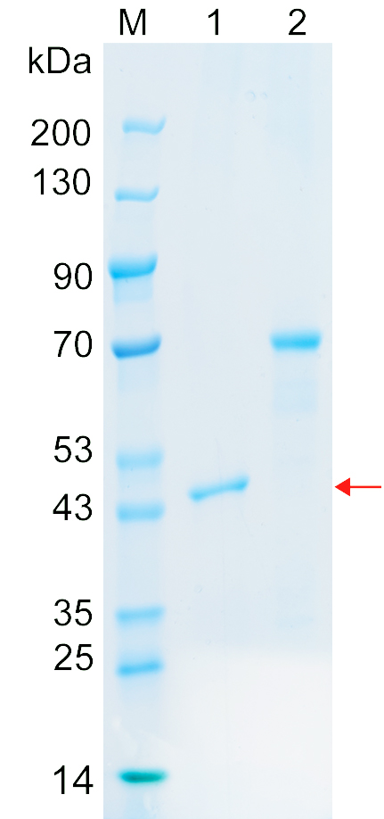 Recombinant LRFN2 protein (His tag) SDS-PAGE