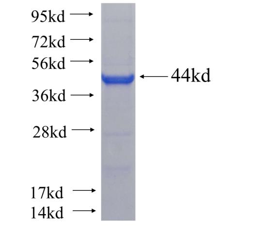 Recombinant human DNMBP SDS-PAGE