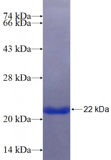 Recombinant Human SAMD8 SDS-PAGE