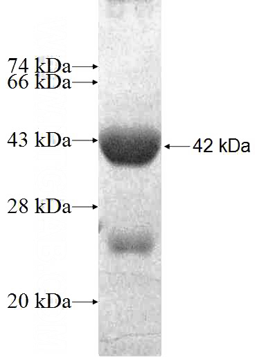 Recombinant Human ACAD9 SDS-PAGE