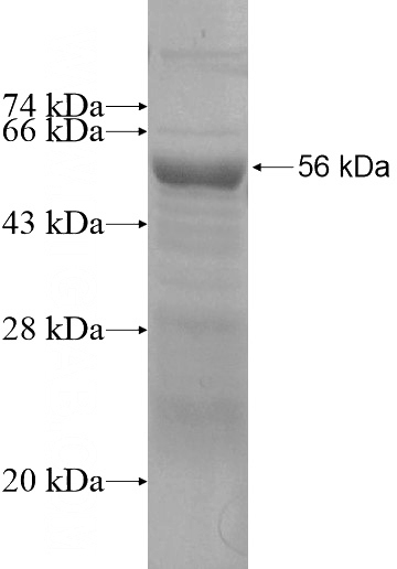 Recombinant Human CBLL1 SDS-PAGE