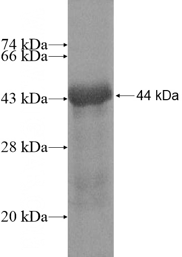 Recombinant Human ZNF219 SDS-PAGE