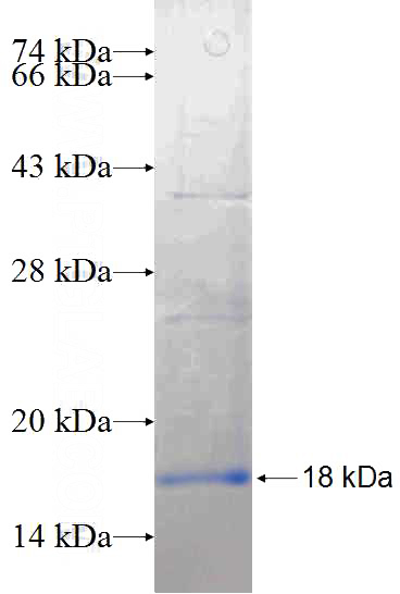 Recombinant Human AP2M1 SDS-PAGE