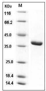 Human ACYP1 / Acylphosphatase-1 Protein (GST Tag) SDS-PAGE