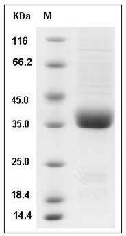Rat IL9R / Interleukin 9 receptor Protein (His Tag) SDS-PAGE