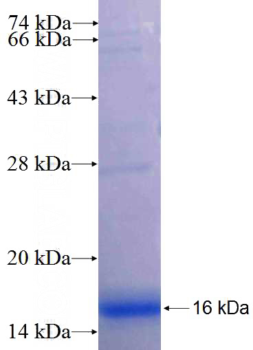 Recombinant Human DFNB59 SDS-PAGE