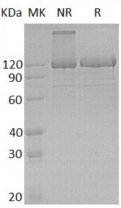 Human PCDH1 (His tag) recombinant protein