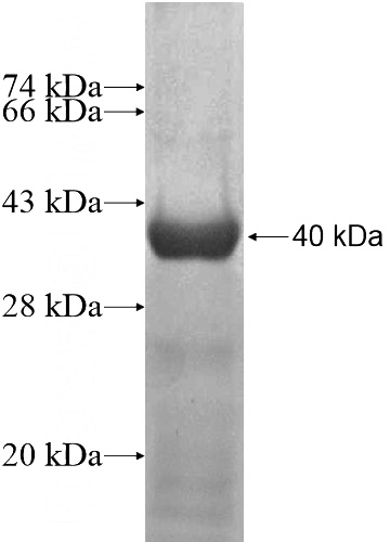 Recombinant Human ZNF480 SDS-PAGE