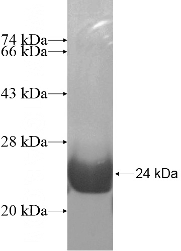 Recombinant Human MRFAP1L1 SDS-PAGE