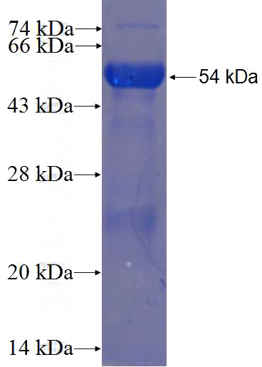 Recombinant Human RNF103 SDS-PAGE