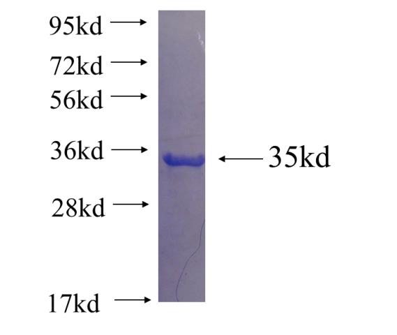Recombinant human CISD2 SDS-PAGE