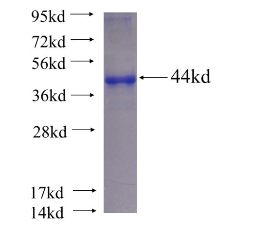 Recombinant human AXIN1 SDS-PAGE