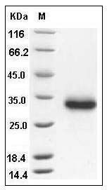Human CD40 / TNFRSF5 Protein (His Tag) SDS-PAGE