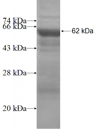 Recombinant Human NOD1 SDS-PAGE