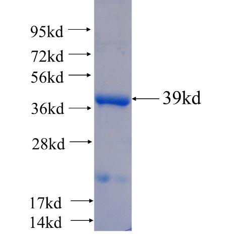Recombinant human ATG4C SDS-PAGE