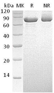 Human PAPSS1/ATPSK1/PAPSS (His tag) recombinant protein