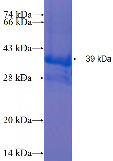 Recombinant Human SAG SDS-PAGE