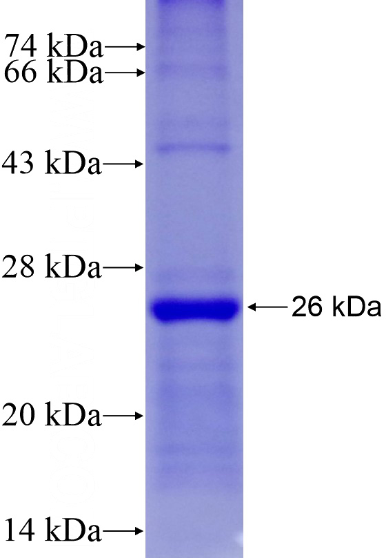 Recombinant Human DRD2 SDS-PAGE