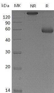 Mouse Lcn2 (Fc tag) recombinant protein