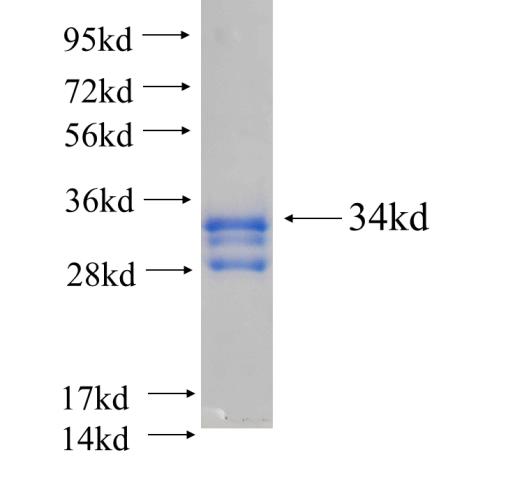 Recombinant human DEFA5 SDS-PAGE