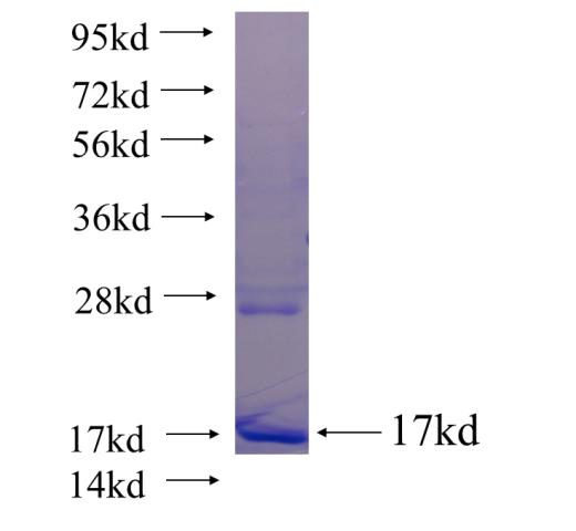 Recombinant human INVS SDS-PAGE