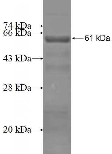 Recombinant Human DYRK1B SDS-PAGE