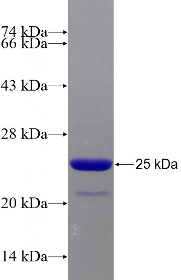 Recombinant Human ARID4B SDS-PAGE