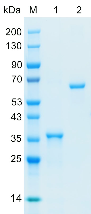 Recombinant PP2AB protein (His tag) SDS-PAGE