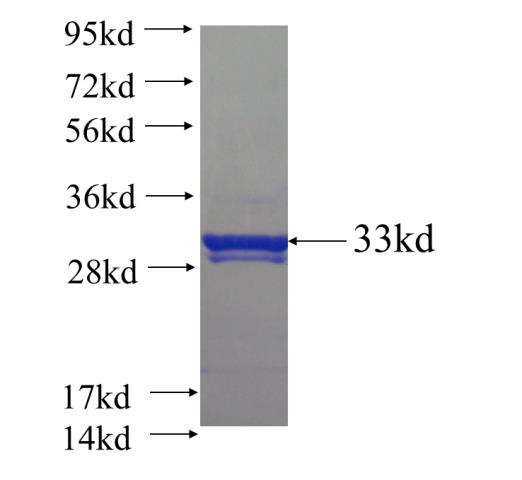 Recombinant human FAM46B SDS-PAGE