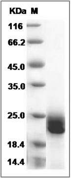 Human Interferon beta / IFN-beta / IFNB Protein SDS-PAGE