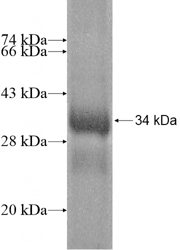 Human DKK2 Recombinant protein (6*His tag)